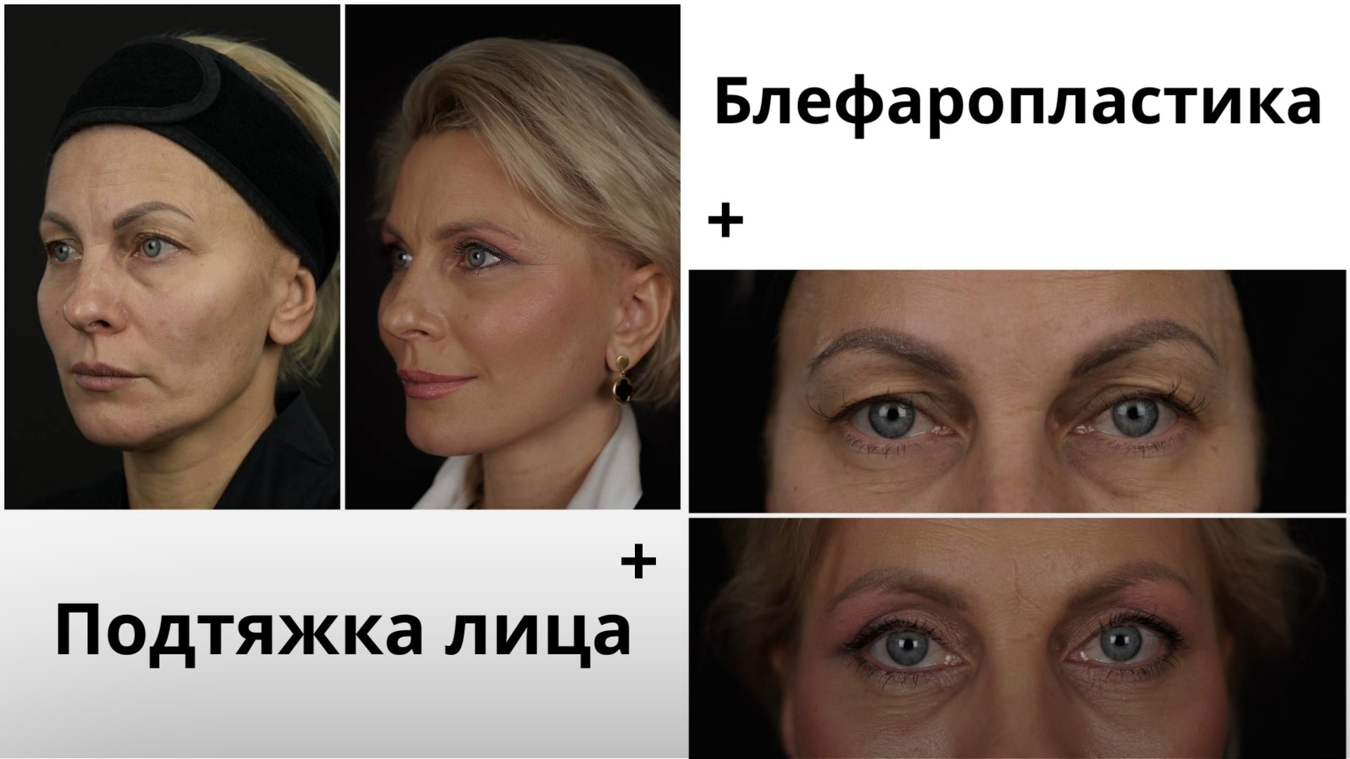 Пластический хирург Лысенко Илья 🪡