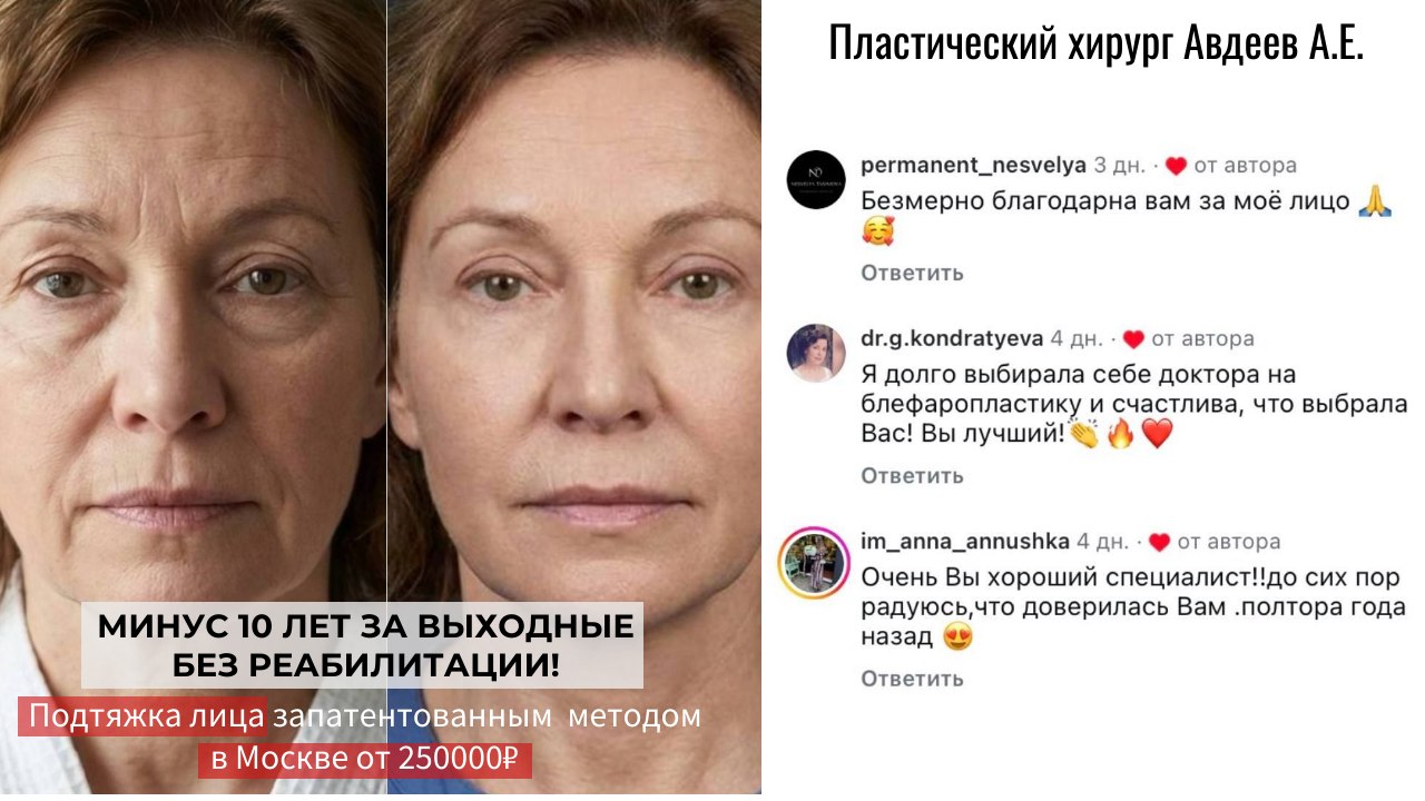 Подтяжка лица без реабилитации