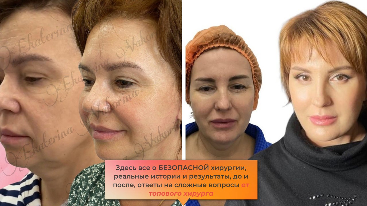 Екатерина Вакорина | Пластический хирург