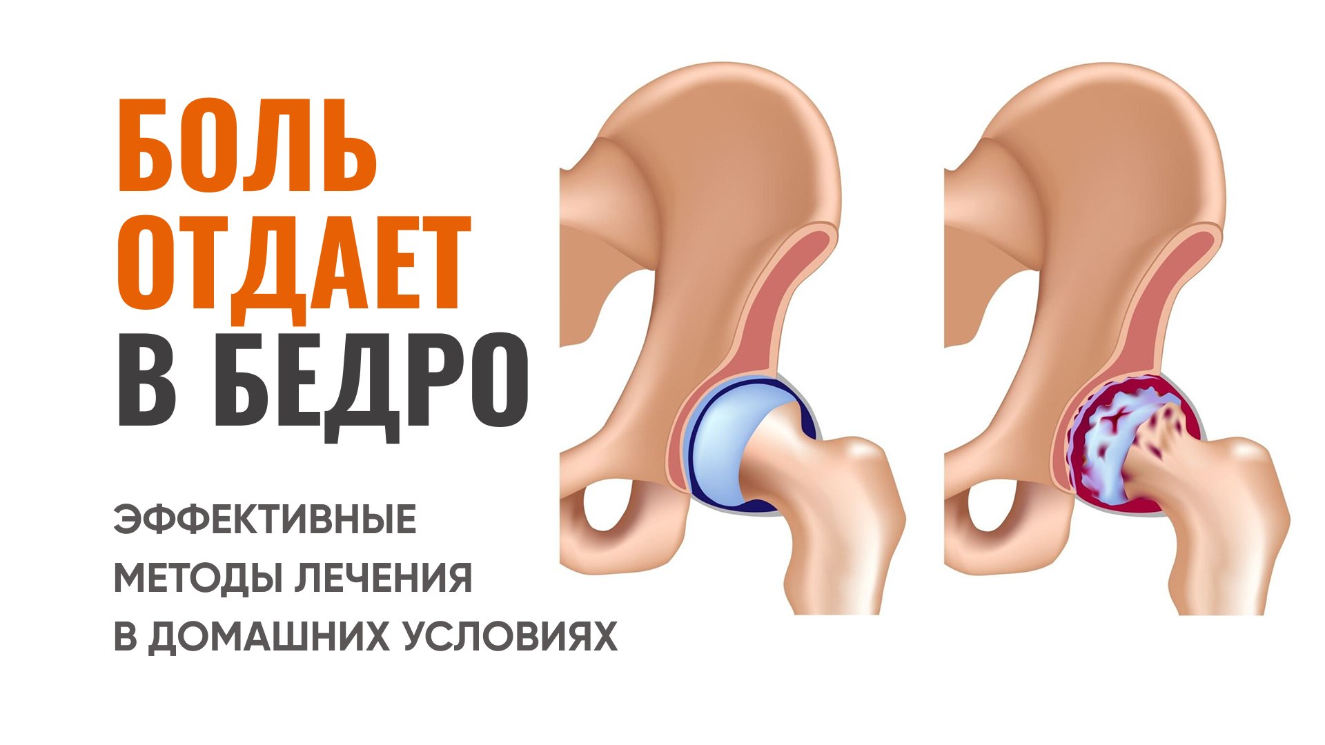 Урок о тазобедренных суставах